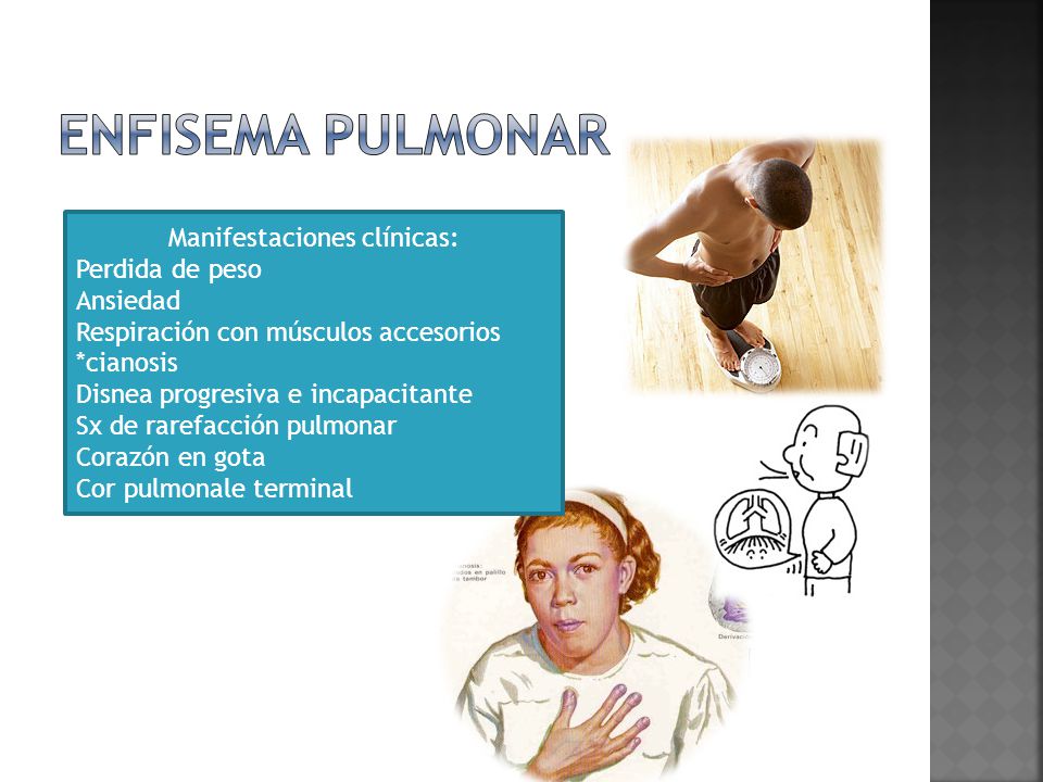 Enfisema y perdida de peso
